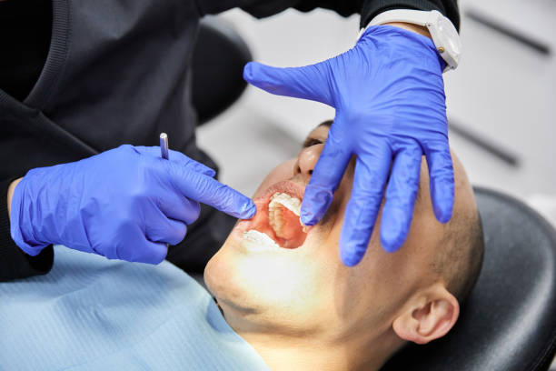 Best Dental Abscess Treatment in Warwick, RI
